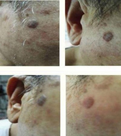 量子氢氧健康第一人长寿哥(廖永贵院士) 让科学量氢氧品牌走向世界!